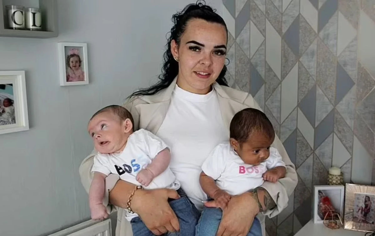 Angleterre : elle accouche de jumeaux à la couleur de peau différente