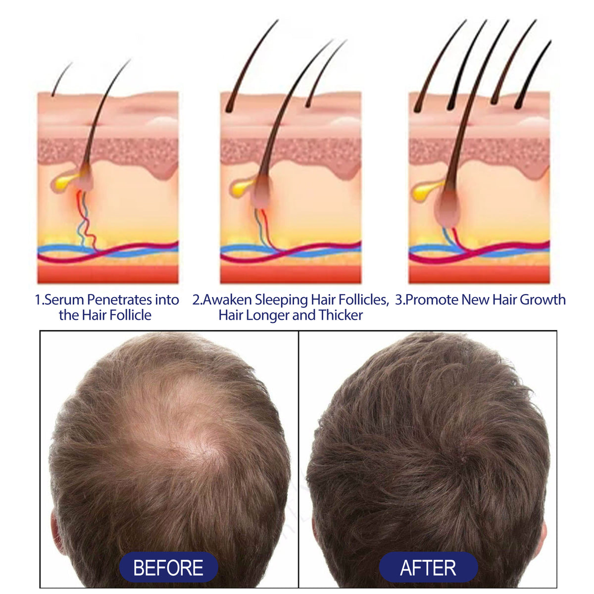 Mousse capillaire pour homme à la biotine et à l’huile de ricin