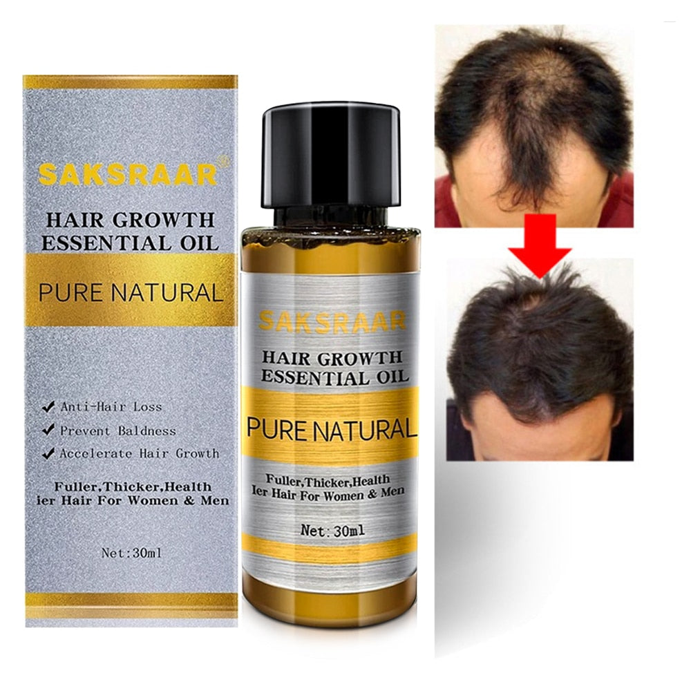 HUILE ESSENTIELLE POUR LA CROISSANCE DES CHEVEUX. - BOSSOUASHOP