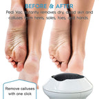 ELECTRIC GRINDER FOR FEET WITH DEAD SKIN